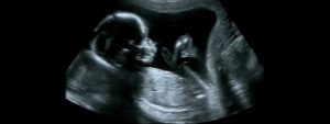 Lee más sobre el artículo Así es la ecografía morfológica del segundo trimestre o de las 20 semanas